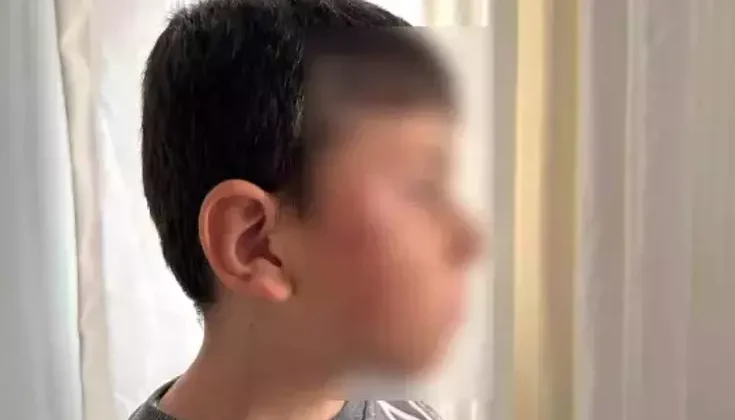 Bursa’da Anne Kavgaya Karışan Öğrenciyi Dövdü